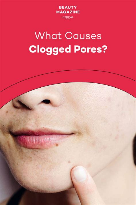 Clogged Pores: What Causes Them and How to UnClog Pores - L’Oréal Paris