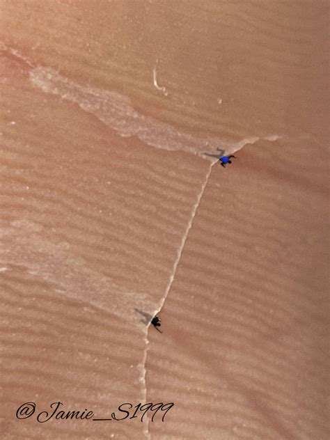 trapped  skin  jamiefeet  deviantart