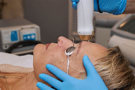 Laser Skin Rejuvenation | Nicole Norris MD Medical Spa | Peru, IL