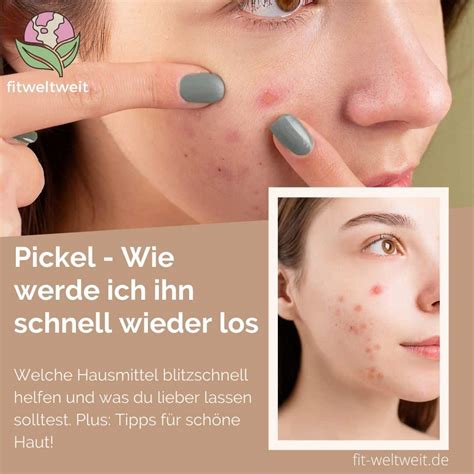 pickel schnell loswerden hilfreiche sos tipps gegen pickel