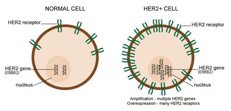 HER2 Receptor and Hormone Receptors ER+ Influence On Breast Cancer