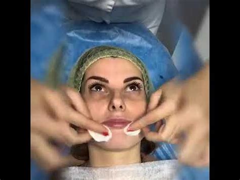 Желтый пилинг Mediderma Retises CT Yellow Peel - YouTube
