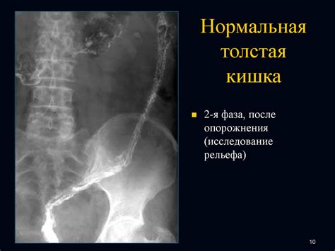 Нормальный пищевод - презентация онлайн