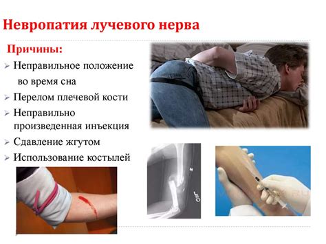 Семиотика поражений периферических нервов верхних конечностей ...