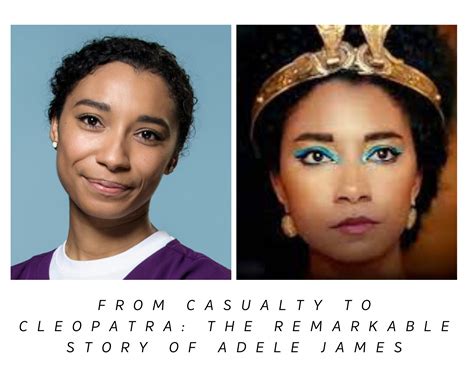 Unveiling Adele James: A Journey From Casualty To Cleopatra » Starbioo.com