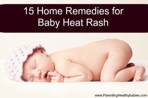 Baby Heat rash or prickly heat is a nightmare for babies in the summer ...