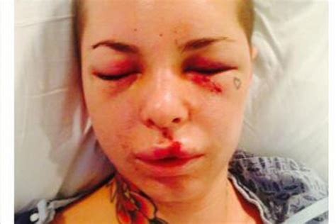 Christy Mack releases statement on alleged War Machine attack: 'I