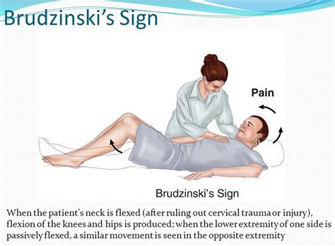 Kernig sign, Brudzinski sign, how to perform Kernig and Brudzinski test