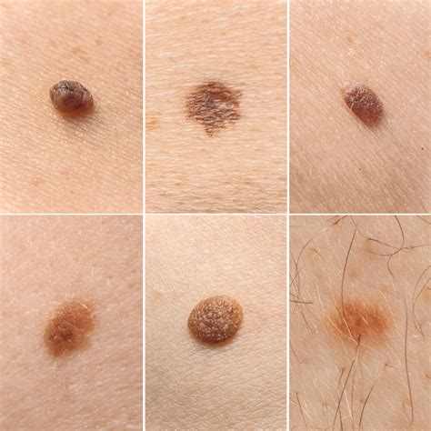 The SHOCKING Truth About Meghan's Mole And Her Twitter Activity Image 14