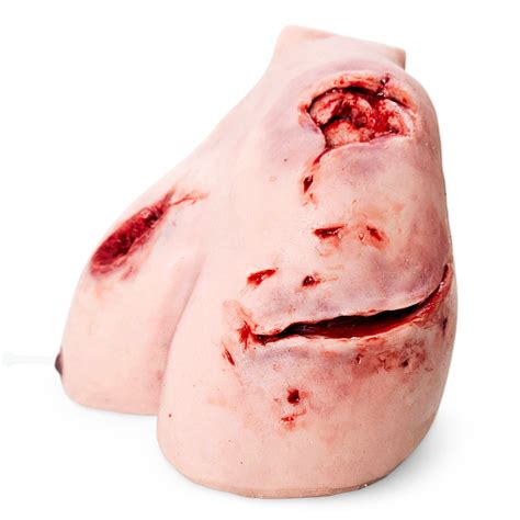 Trauma Wound Packing Shoulder - MedicFX