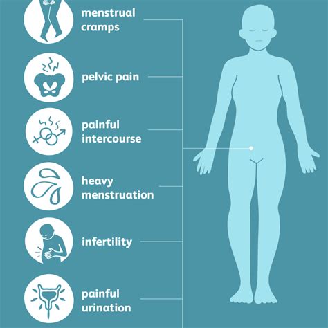 Symptoms of Endometriosis