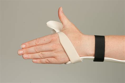 Extensor Tendon Repair (thumb), a guide to your therapy - Leeds