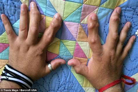 NjrOCKsNaija: Photos: Man with the largest feet in the world wants them ...