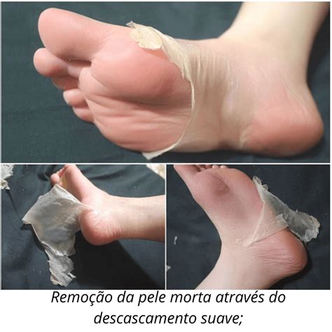 Esfoliação Para Os Pés - Máscaras De Esfoliação Para Os Pés Com Aloe Vera