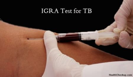 Interferon-Gamma Release Assays (IGRAs) Test for Tuberculosis | Health ...