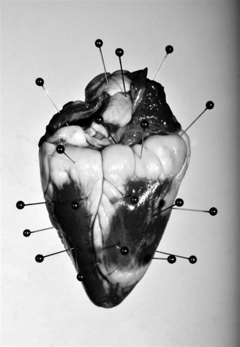 17 Best images about Heart on Pinterest | Human anatomy, Medical ...