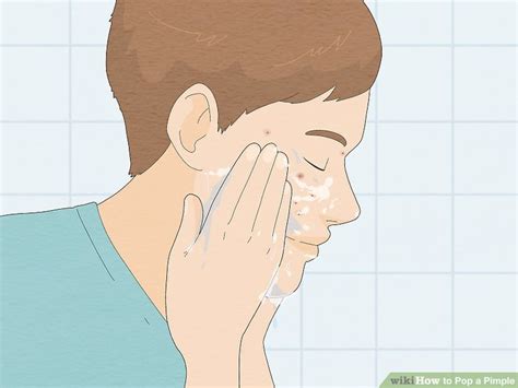 how to get a pimple to pop