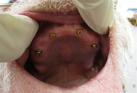 dentures    portland  swiss denture center