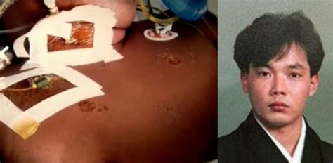 Hisashi Ouchi: History's Worst Radiation Victim Kept Alive For 83 Days ...