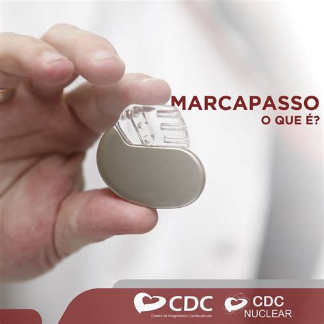 Marca Passo Ou Marcapasso - Implante De Marcapasso Saiba Mais Sobre O Procedimento Clnica Ritmo