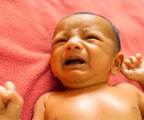 Bebê Com Pele Amarelada O Que Pode Ser - Bebê com pele amarelada? Entenda o que é icterícia e quais são seus ...