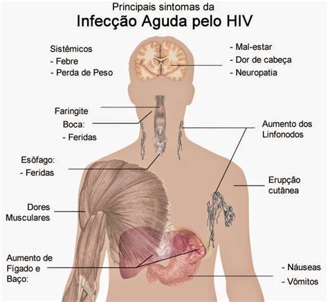 Qual É O Sintoma Da Aids - AIDS e HIV