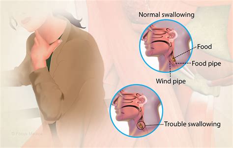 Health Condition : Symptoms, Causes, Treatment and More