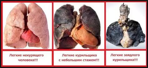 Как выглядят легкие?