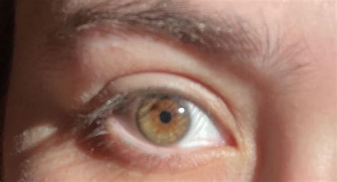 heterochromia eyes brown  green