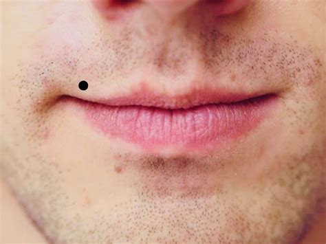 Lucky Moles On Male Body Meaning in hindi Meets very loving partner