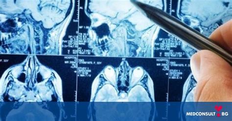 Кога главоболието се свързва с мозъчни тумори — Medconsult.bg