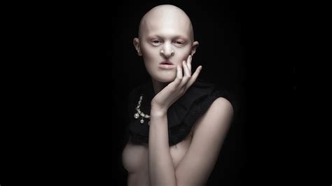 Melanie Gaydos je modelka se závažnou genetickou vadou. I přes svůj ...