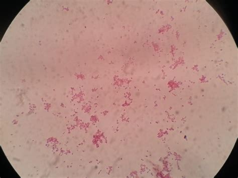 Kingella case report: Patient history, Lab diagnosis and treatment