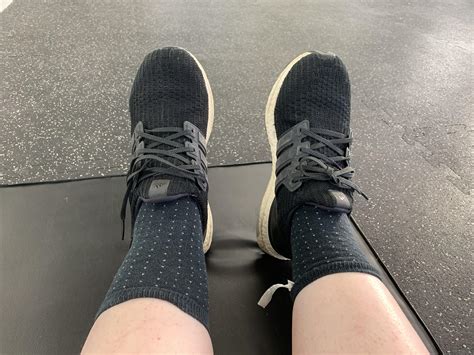 I fractured my left ankle 3 years ago and it is still visibly swollen