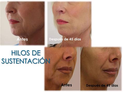 Cosmetic Surgery – Dental Bio-Esthetics