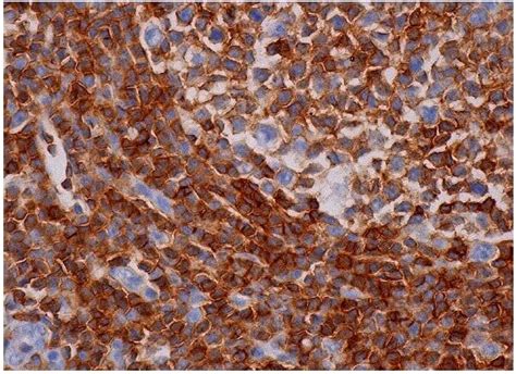 Anti-CD45 Antibody (2D-1) | SCBT - Santa Cruz Biotechnology