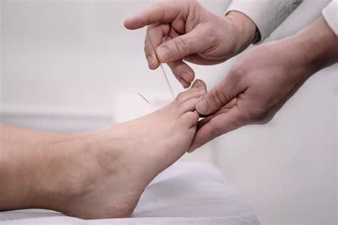 Diabetic Neuropathy: Nerve Damage Symptoms and Treatment