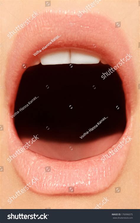 Open Mouth White Healthy Teeth Stock Photo 176996075 | Shutterstock