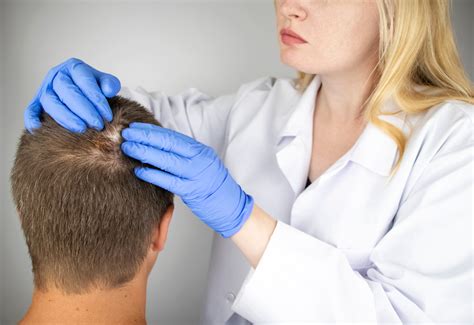 Platelet-Rich Plasma (PRP) Therapy for Hair Restoration