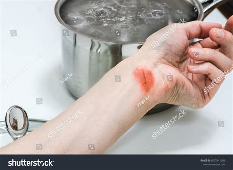 Hospital Water Mark Photos and Images | Shutterstock