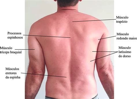 Lombo Parte Do Corpo