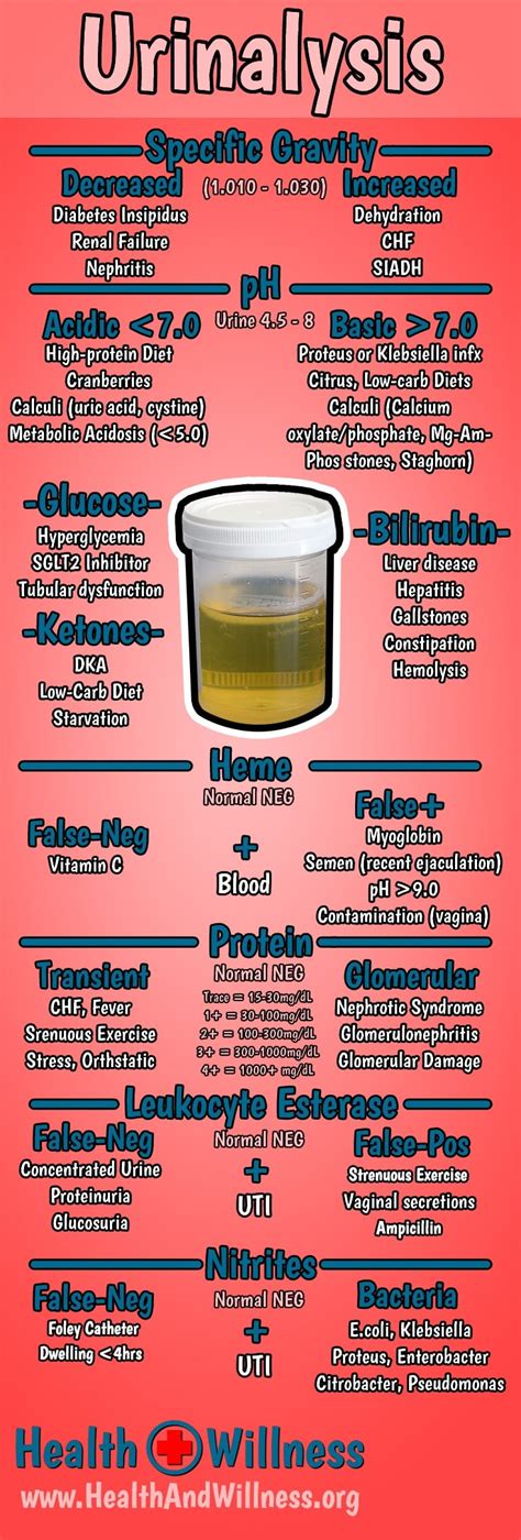 Urinalysis Explained