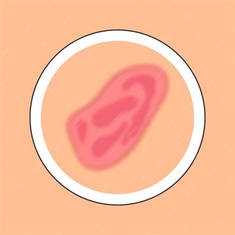 Różowa i brzoskwiniowa ikona koło siniak choroby skóry w stylu płaski