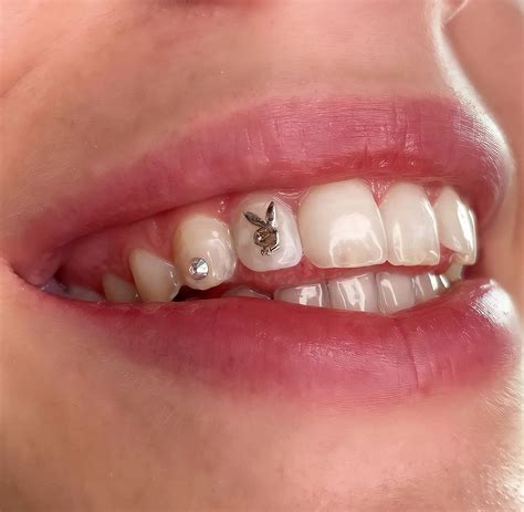 how to remove tooth gem glue at home