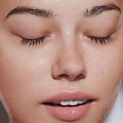 Acne-Treating Tips and Product Recommendations for Blemish-Free Skin