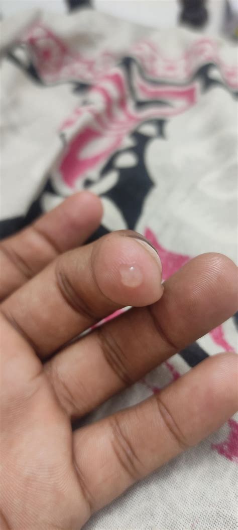 What is this I have sore throat also and shortness of breath : r/HIV