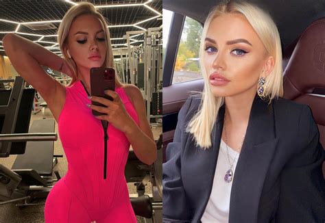 Милана Тюльпанова показала лицо до пластики, и у этой девушки нет ни ...