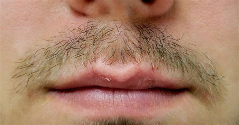 What do you guys do about hairs that grow upwards? : r/Moustache
