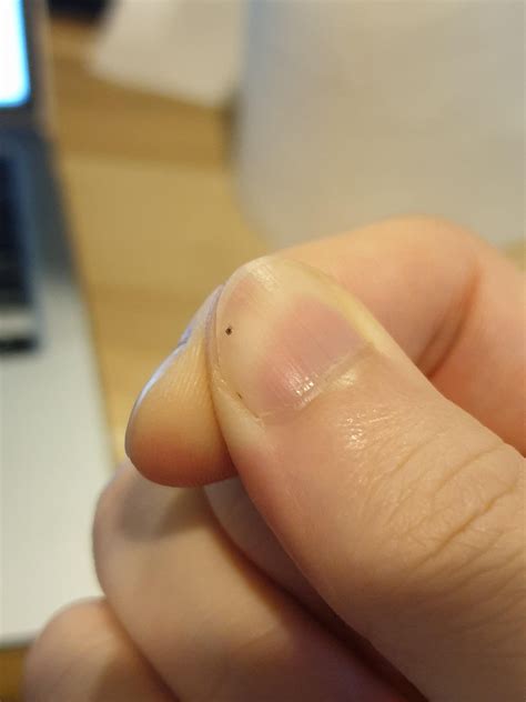 What is this mite/bug? Could feel it crawling all over me but no bites