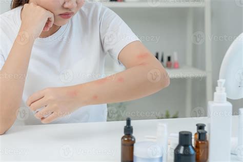 Skin and beauty problems Women have itchy skin and red rashes from